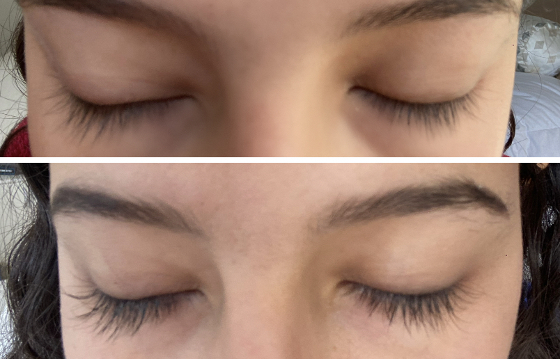 Comparison photo of before eyelash serum and after