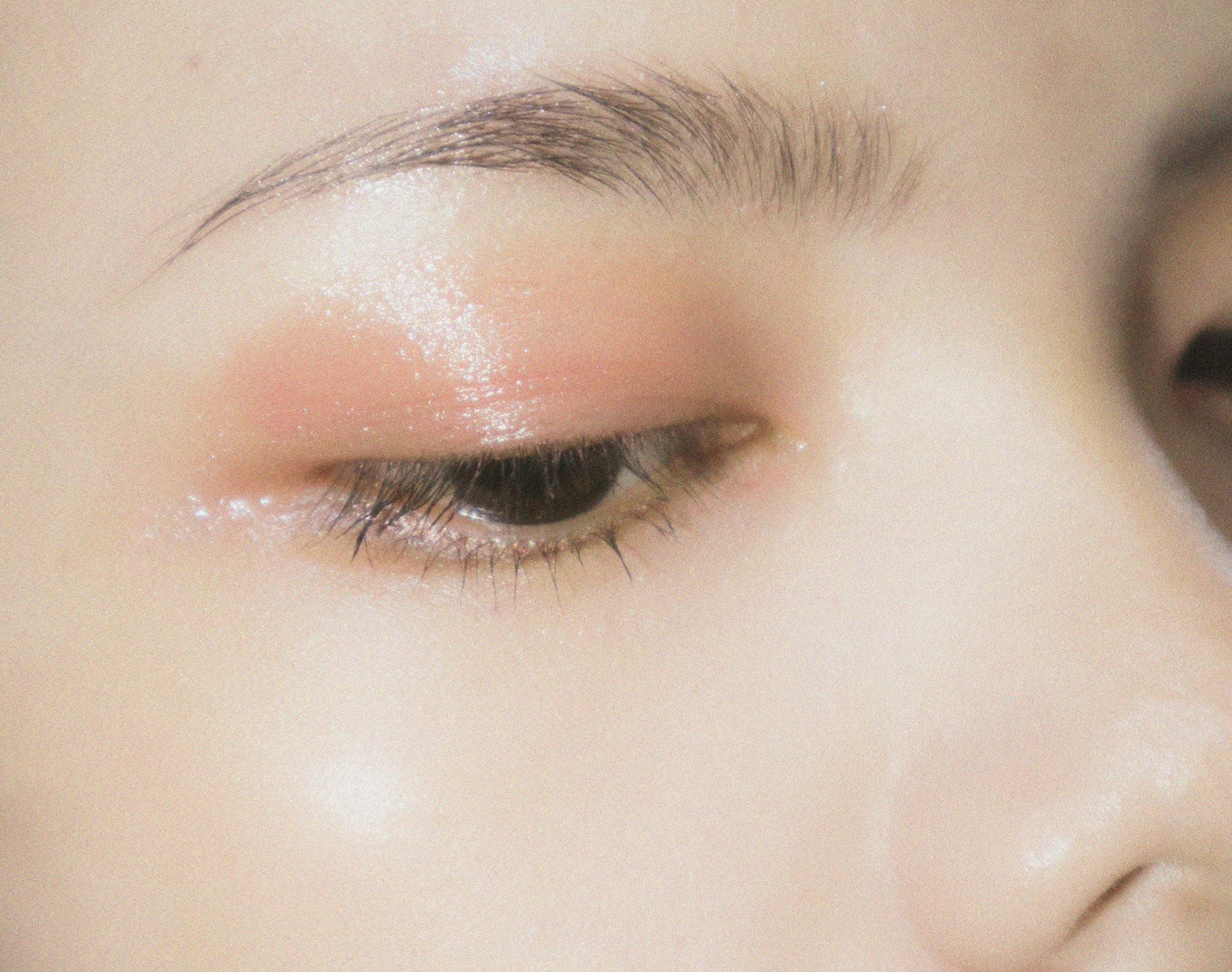 the best natural treatments for acne