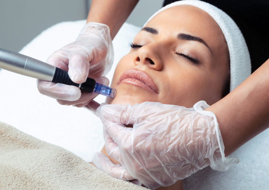 skincare post microneedling