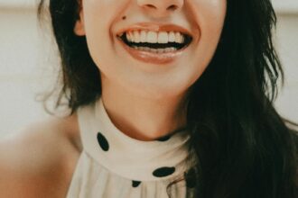 My first hand experience wearing aligners for a year