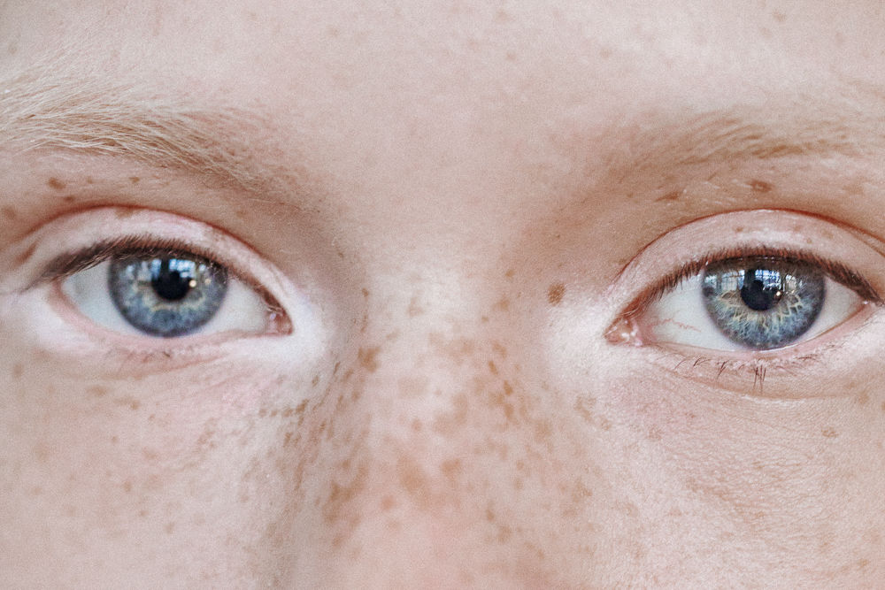 Why Regular Moisturiser Isn’t Enough for the Eye Area